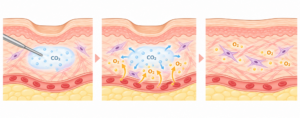 Three-panel diagram of alveolar gas exchange showing CO2 in the air sac first, then O2 diffusing into blood in the middle, and O2-rich blood leaving in the last panel.